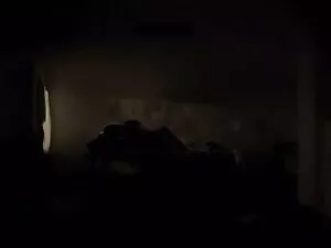 एक गुदा संकलन (द्वि  ...