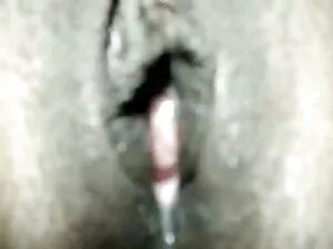 स्ट्रैपिंग चमत्कार ह ...